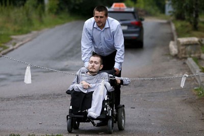 اخبار , اخبار گوناگون, جراحی پیوند سر