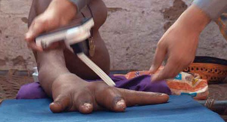 اخبار , اخبار گوناگون , بیماری عجیب 