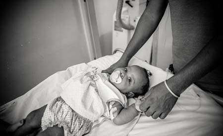 اخبار , اخبار گوناگون,دوقلوهای به هم چسبیده,تصاویر دوقلوهای به هم چسبیده