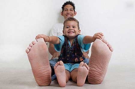 این جوان بزرگترین پای جهان را دارد این جوان بزرگترین پای جهان را دارد