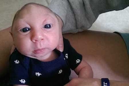 اخبار , اخبار گوناگون, نوزاد بدون مغز