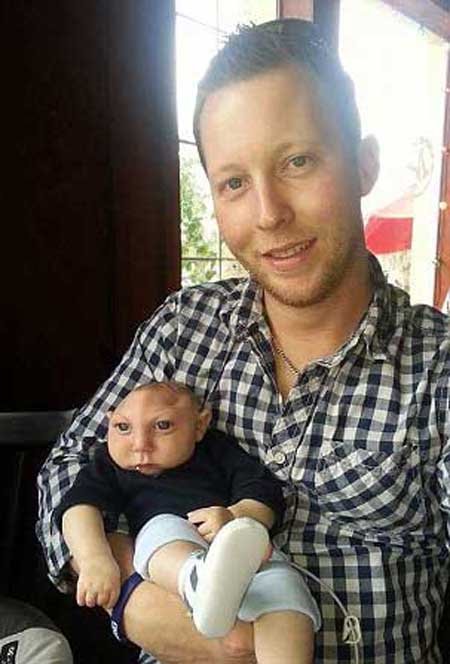 اخبار , اخبار گوناگون, نوزاد بدون مغز