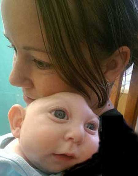 اخبار , اخبار گوناگون, نوزاد بدون مغز