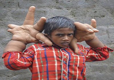 اخبار,اخبار گوناگون,شگفت انگیزترین انسان ها