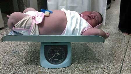 بُزرگ‌ترین نوزاد تاریخ هِند با وزن ۶.۷ کیلوگرم متولد شُد! 1