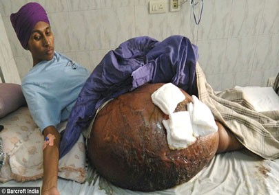 اخبار,اخبار گوناگون , تومور