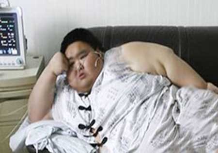 سنگین‌وزن‌ترین زن چین زیر تیغ عمل جراحی