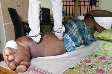  اخبارگوناگون  ,خبرهای  گوناگون , مردی با پاهای عجیب  