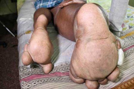  اخبارگوناگون  ,خبرهای  گوناگون , مردی با پاهای عجیب  