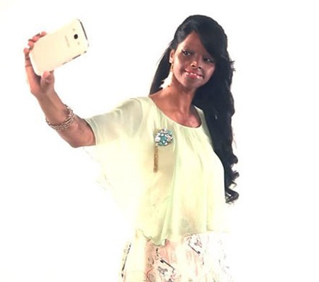 اخبار , اخبار گوناگون,تصاویر دختر هندی قربانی اسیدپاشی,تصاویر قربانیان اسیدپاشی اخبار , اخبار گوناگون,تصاویر دختر هندی قربانی اسیدپاشی,تصاویر قربانیان اسیدپاشی