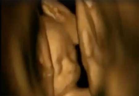 رقص جنین در شکم مادر رقص جنین در شکم مادر