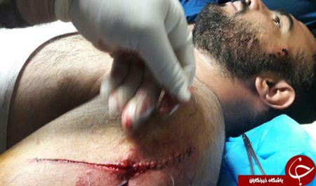 دو شهربان شهرداری با چاقوی قانون شكنان مجروح شدند/شهاب حسینی از ناحیه سینه آسیب دید 1
