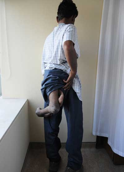 اخبارگوناگون,خبرهای گوناگون,جوانِ چهارپا