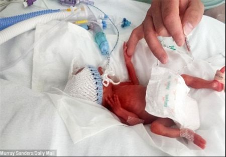 اخبارگوناگون,خبرهای گوناگون,کوچکترین سهقلوه اخبارگوناگون,خبرهای گوناگون,کوچکترین سهقلوه