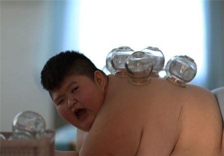 اخبارگوناگون,خبرهای گوناگون,چاق‌ترین کودک جهان