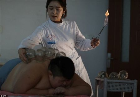 اخبارگوناگون,خبرهای گوناگون,چاق‌ترین کودک جهان