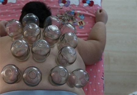 اخبارگوناگون,خبرهای گوناگون,چاق‌ترین کودک جهان