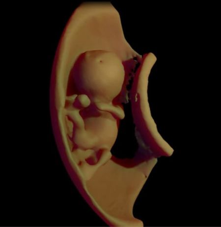   اخبارعلمی,خبرها علمی,سفر مجازی به دنیای جنین
