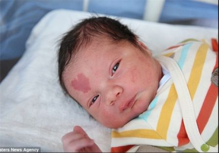 اخبارگوناگون,خبرهای گوناگون,نوزادی با علامت قلب
