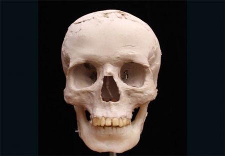 اخبارگوناگون,خبرهای گوناگون,بازسازی چهره