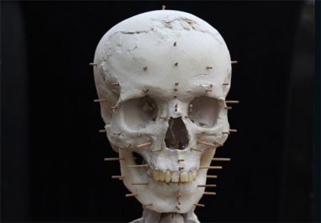 اخبارگوناگون,خبرهای گوناگون,بازسازی چهره