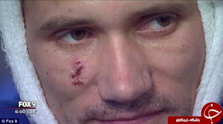 اخبارگوناگون,خبرهای گوناگون,ماجرای عجیب میخ