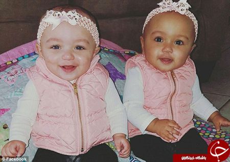   اخبار  گوناگون ,خبرهای   گوناگون ,دوقلوهایی با رنگ‌های متفاوت 