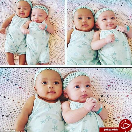   اخبار  گوناگون ,خبرهای   گوناگون ,دوقلوهایی با رنگ‌های متفاوت 