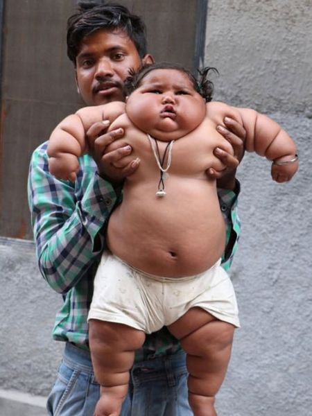 اخبار,اخبار گوناگون,شیرخوار هندی با چاقی بیش از حد اخبار,اخبار گوناگون,شیرخوار هندی با چاقی بیش از حد