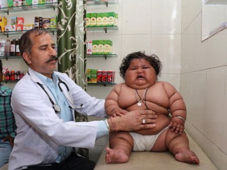 اخبار,اخبار گوناگون,شیرخوار هندی با چاقی بیش از حد اخبار,اخبار گوناگون,شیرخوار هندی با چاقی بیش از حد