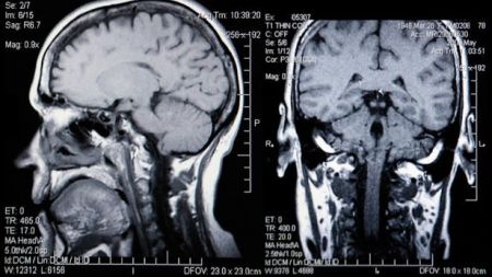 اخبارعلمی ,خبرهای علمی ,سن مغز اخبار علمی ,خبرهای علمی ,سن مغز