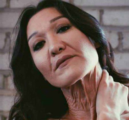 اخبار,اخبار گوناگون,دختر جوانی که پیر شده است اخبار,اخبار گوناگون,دختر جوانی که پیر شده است