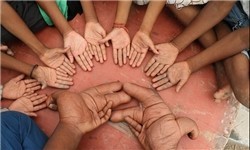 اخبار,اخبار گوناگون,دستان عجیب نوجوان هندی اخبار,اخبار گوناگون,دستان عجیب نوجوان هندی