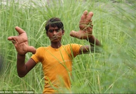 اخبار,اخبار گوناگون,دستان عجیب نوجوان هندی اخبار,اخبار گوناگون,دستان عجیب نوجوان هندی