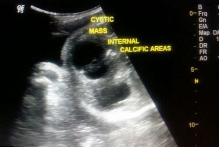   اخبار گوناگون ,خبرهای گوناگون,نوزاد هندی