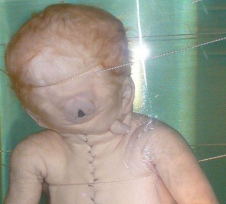 اخبار,اخبار گوناگون,عجایب ترسناک دنیای پزشکی