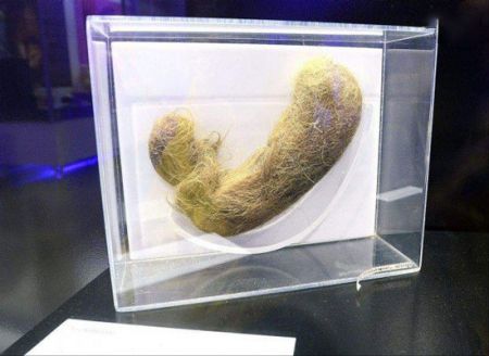 اخبار,اخبار گوناگون,عجایب ترسناک دنیای پزشکی