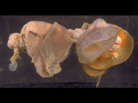 اخبار,اخبار گوناگون,عجایب ترسناک دنیای پزشکی