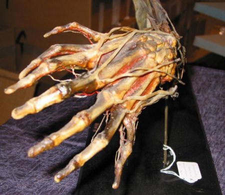 اخبار,اخبار گوناگون,عجایب ترسناک دنیای پزشکی