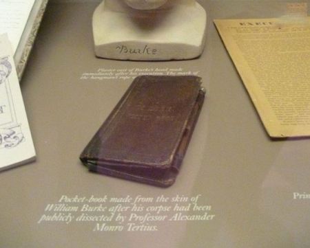 اخبار,اخبار گوناگون,عجایب ترسناک دنیای پزشکی