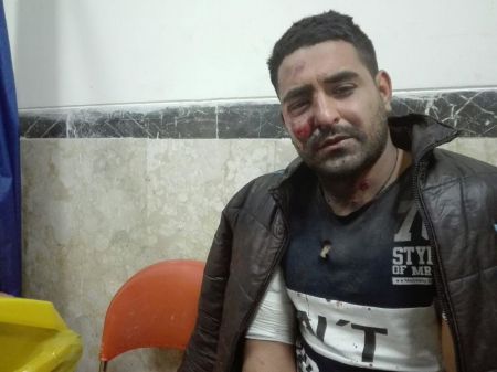 حوادث چهارشنبه سوری/ 512 مصدوم در کل کشور