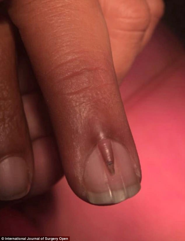 اخبار,اخبارگوناگون,راز ناخن عجیب مرد پاکستانی 