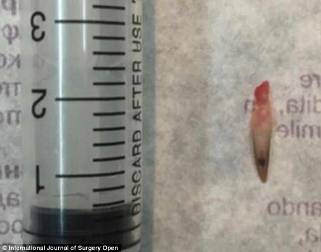 اخبار,اخبارگوناگون,راز ناخن عجیب مرد پاکستانی 