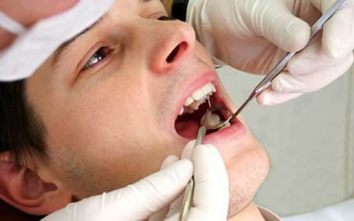 اخبار پزشکی ,خبرهای پزشکی , پلاک دهان اخبار پزشکی ,خبرهای پزشکی, پلاک دهان