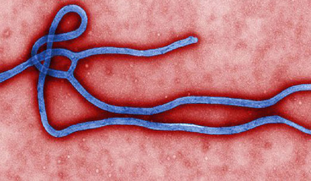  اخبار پزشکی ,خبرهای پزشکی,آنتی بادی ابولا