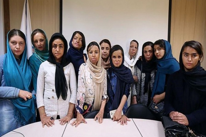 اخباراجتماعی ,خبرهای اجتماعی ,دختران شین آباد اخبار اجتماعی ,خبرهای اجتماعی,دختران شین آباد