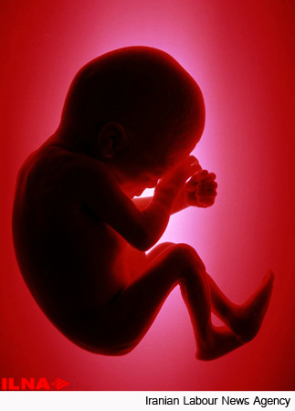 اخبار پزشکی ,خبرهای پزشکی ,ناباروری اخبار پزشکی ,خبرهای پزشکی,ناباروری