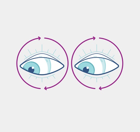 درمان خانگی انحراف چشم نوزاد, ورزش برای درمان انحراف چشم, درمان غیر جراحی انحراف چشم