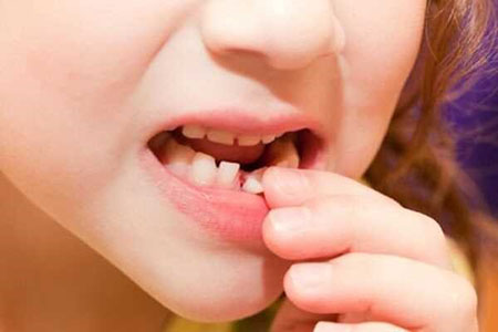  پَری دندان, رسم افتادن اولین دندان شیری, رسم افتادن دندان در مکزیک