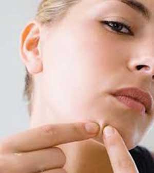 ویتامین های ضد جوش,مقابله با جوش صورت,درمان جوش های صورت
